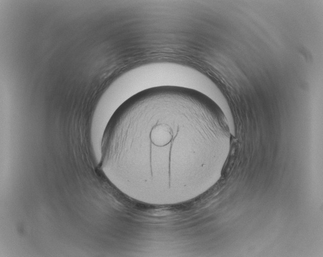 X0000114100219200911161105