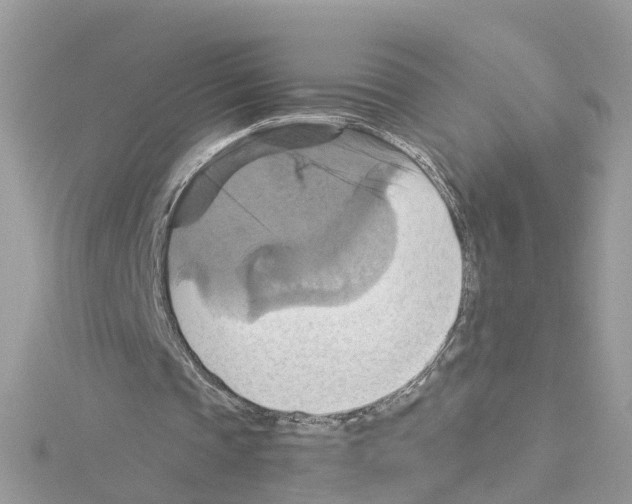 X0000114100337200911161102