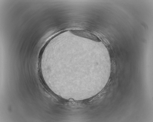 X0000114100338200911161102