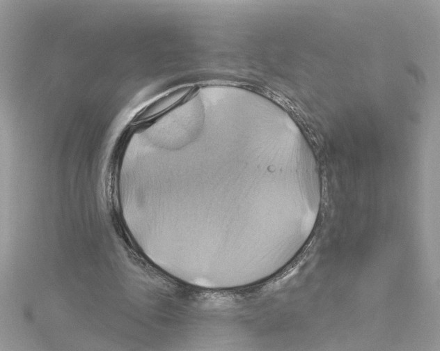 X0000114100343200911161102