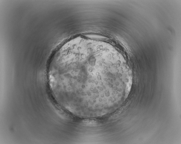 X0000114100354200911161102