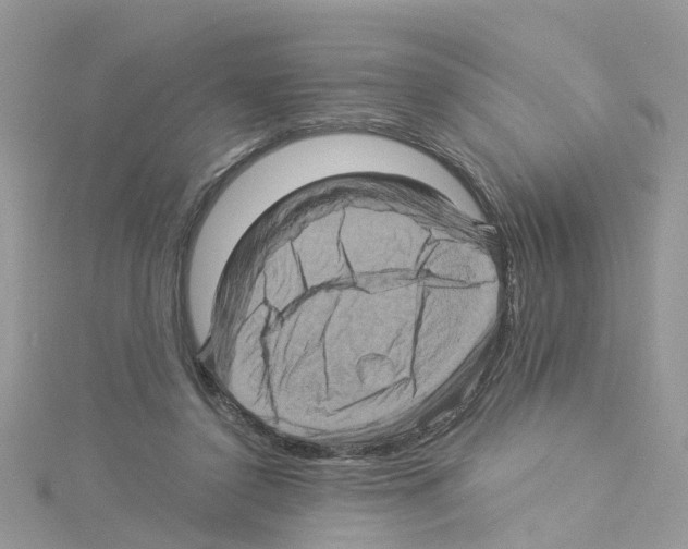 X0000114100356200911161102