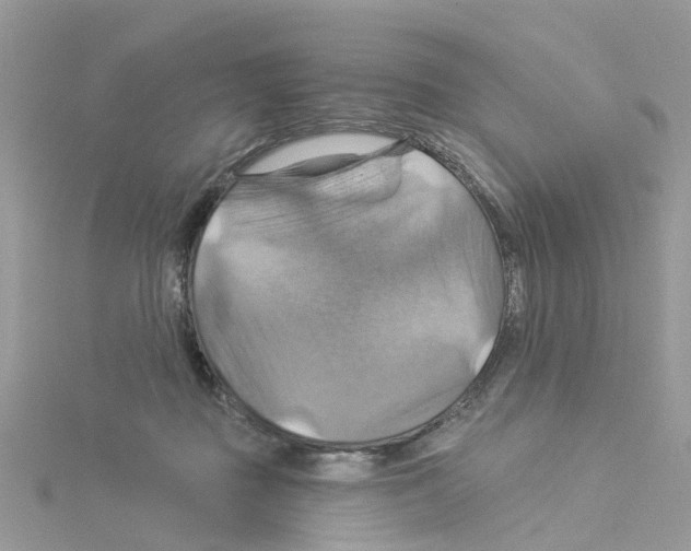 X0000114100363200911161103