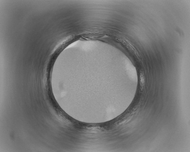 X0000114100396200911161102