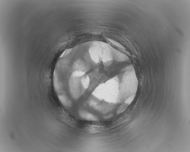 X0000114100466200911161101