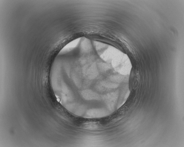 X0000114100499200911161101