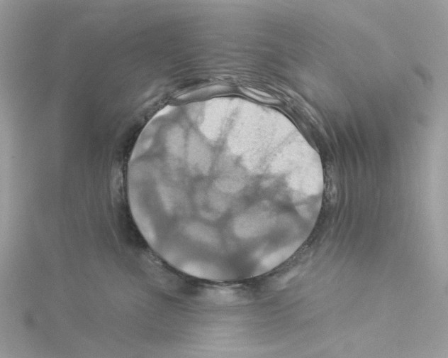 X0000114100523200911161100