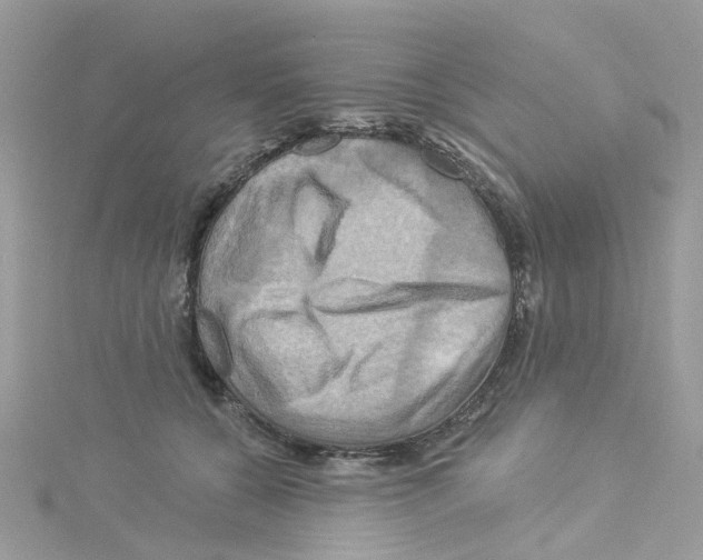 X0000114100560200911161100