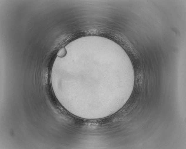 X0000114100694200911161058