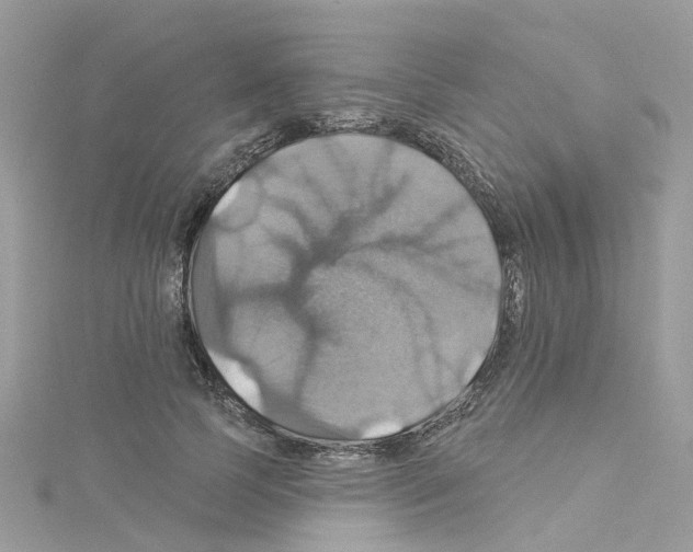 X0000114100745200911161058