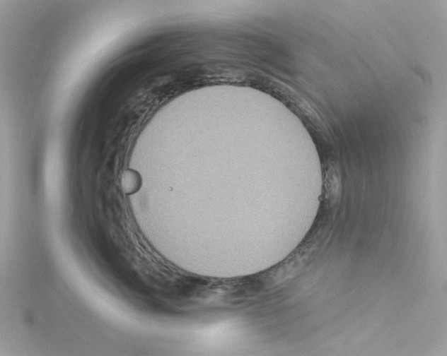 X0000114100764200911161058