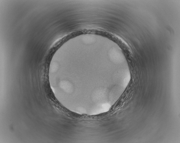 X0000114100775200911161057