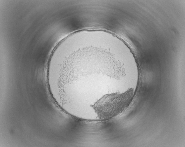 X0000114100856200911161057