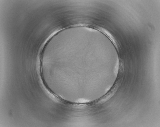 X0000114100859200911161057