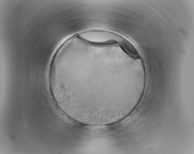 X0000114100864200911161057