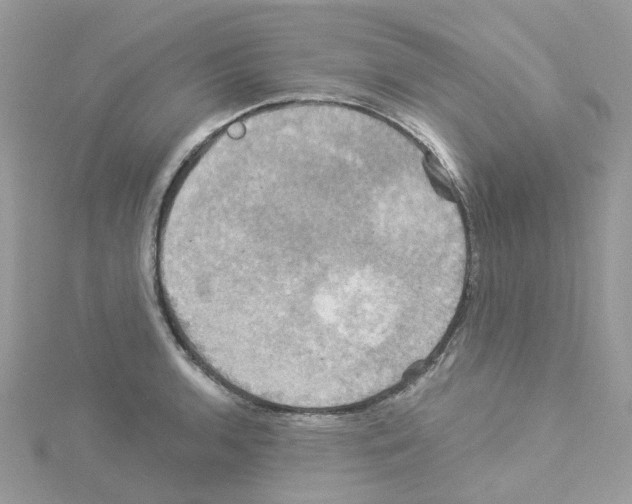 X0000114101136200911161052