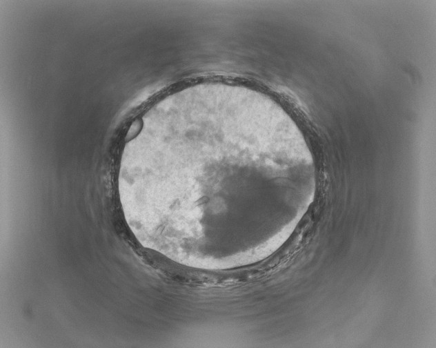 X0000114101159200911161052