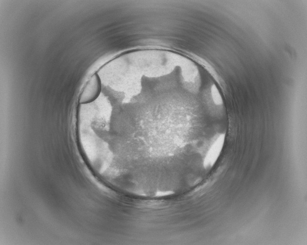 X0000114101387200911161049