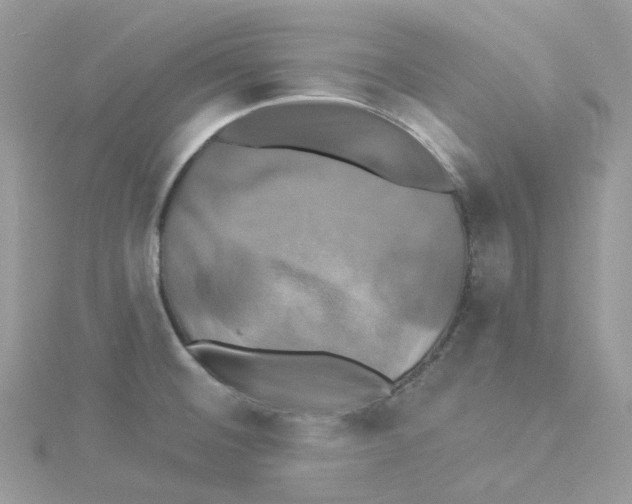 X0000114101476200911161048