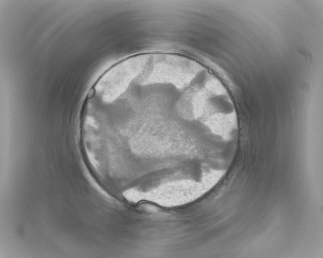 X0000114101479200911161048