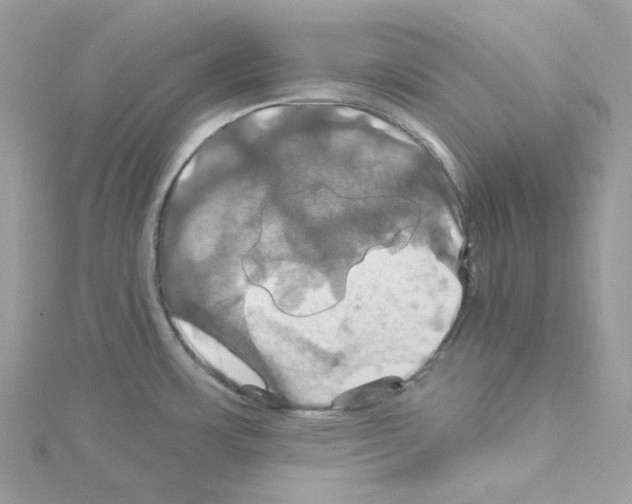 X0000114101483200911161048