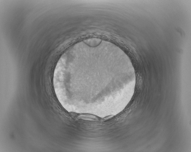 X0000114101489200911161047