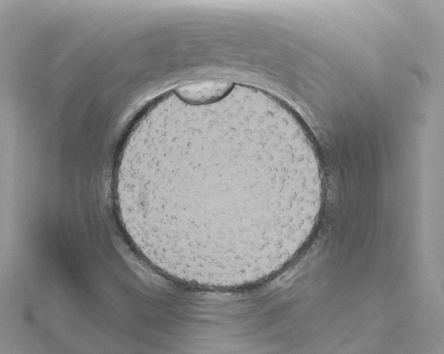 X0000114101499200911161047