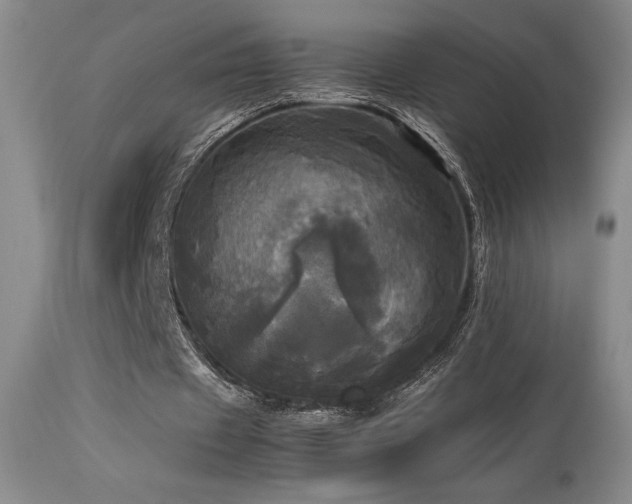 X0000114110433200910051517
