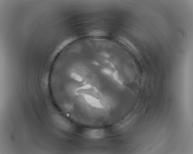 X0000114110155200910191710