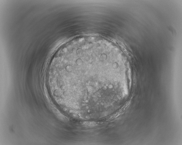 X0000114110145200911161125