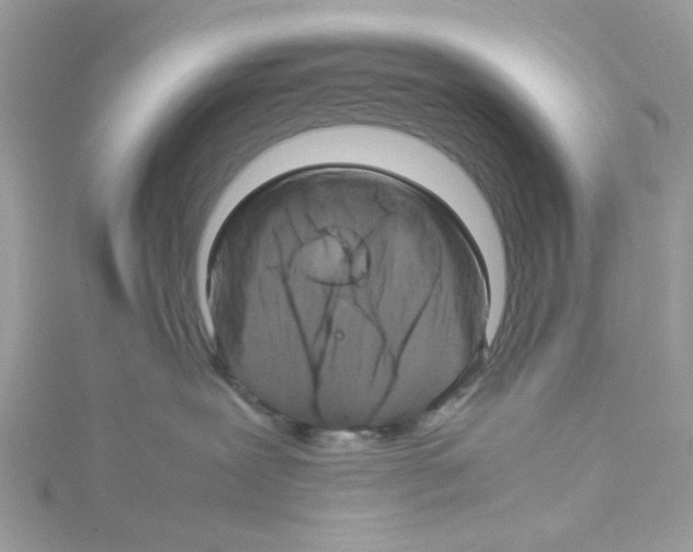 X0000114110239200911161125