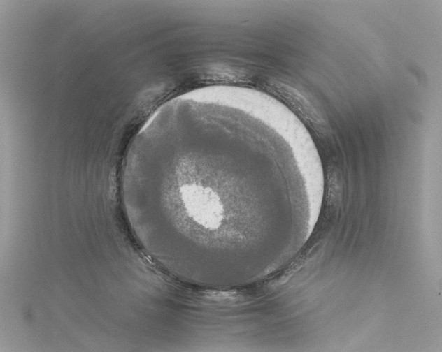 X0000114110457200911161122