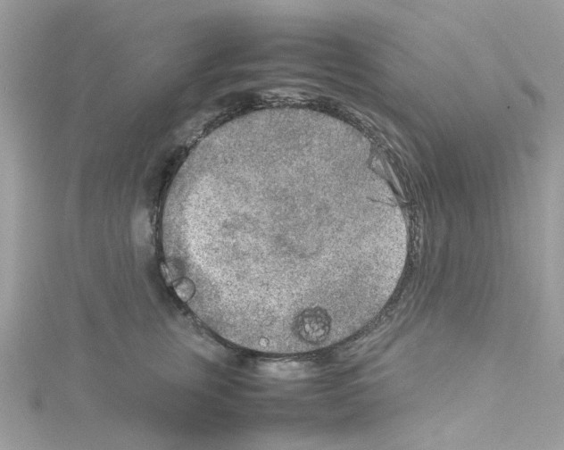 X0000114110759200911161118