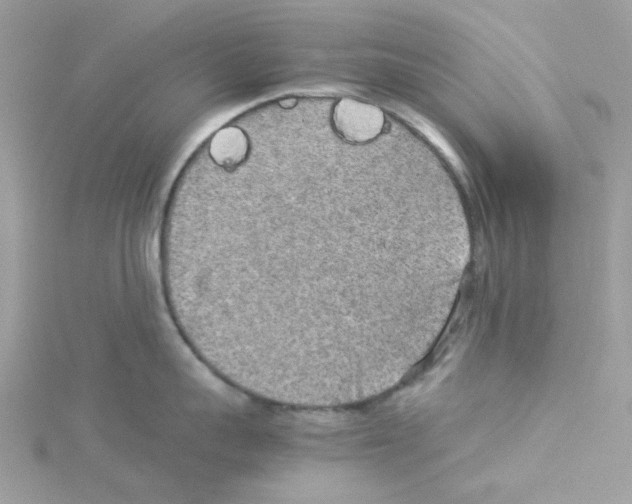 X0000114110959200911161116