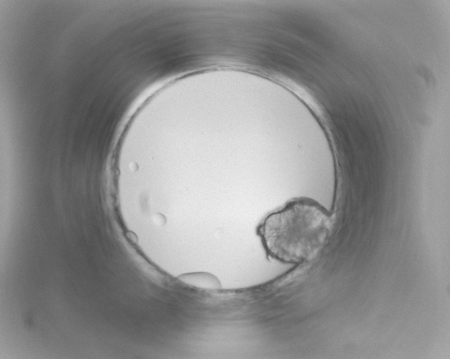 X0000114111056200911161115