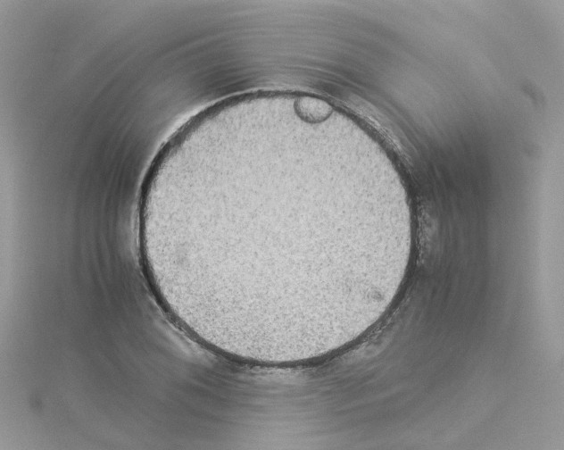 X0000114111076200911161114