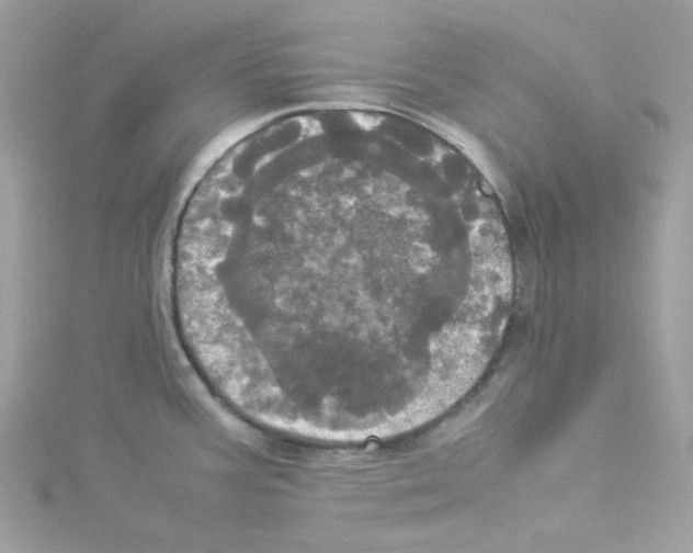 X0000114111387200911161110