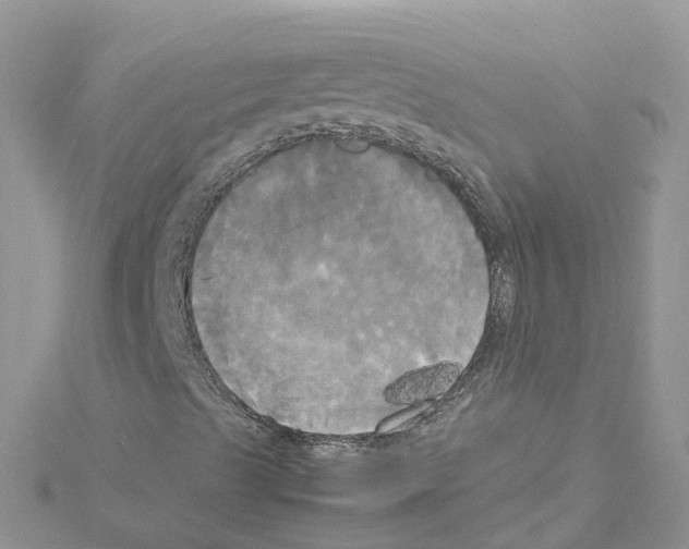 X0000114111489200911161108