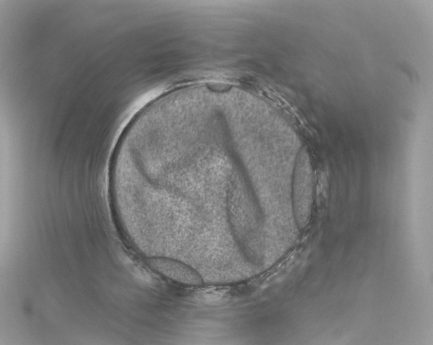 X0000114120148200911161146