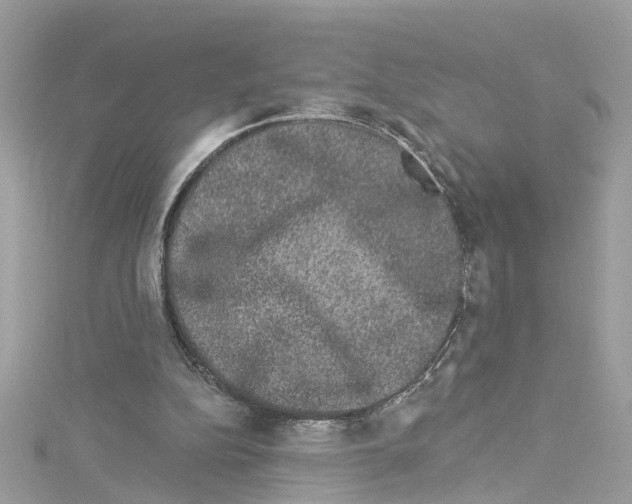 X0000114120152200911161146