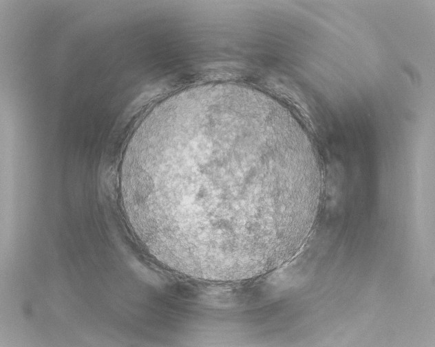 X0000114120162200911161146