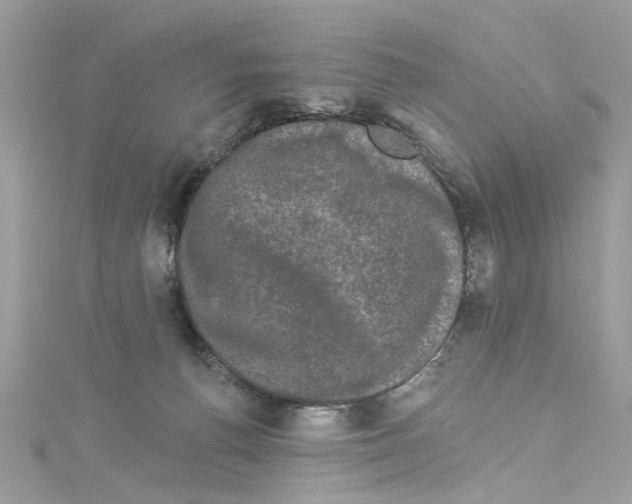 X0000114120176200911161146