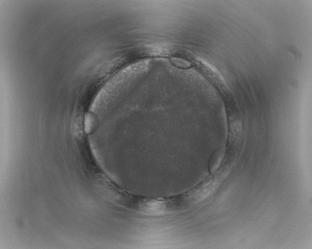 X0000114120325200911161144