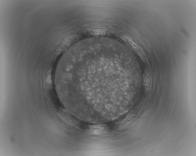 X0000114120516200911161142