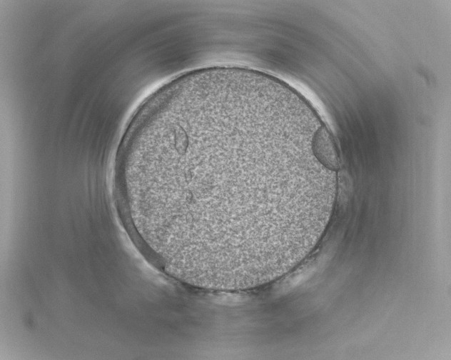 X0000114120815200911161138