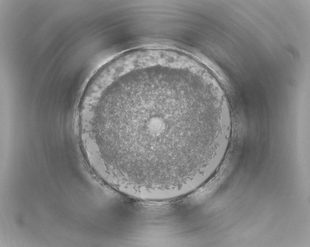 X0000114120856200911161137