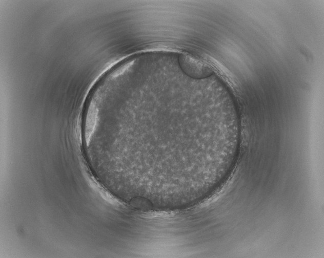 X0000114120892200911161137