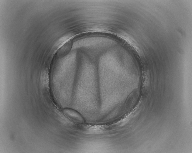 X0000114120969200911161135