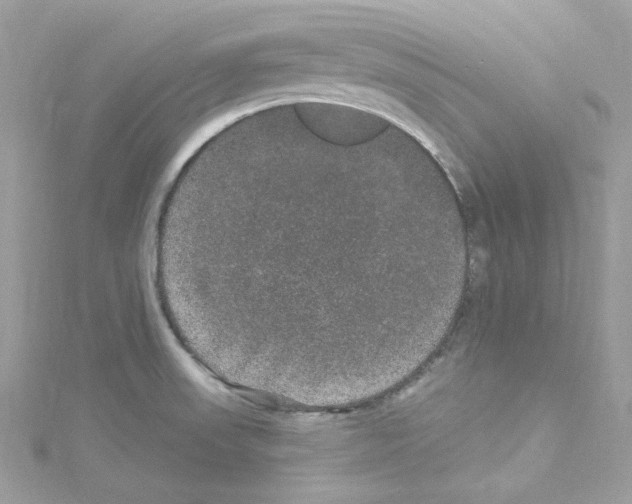 X0000114121523200911161128