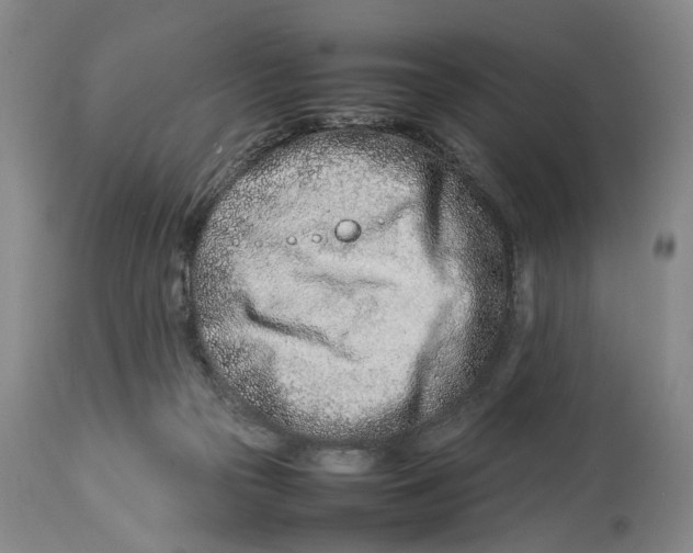 X0000114140169200911051428